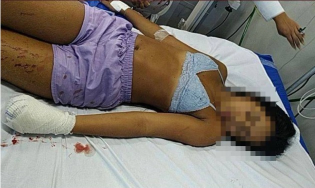 Jovem que foi baleada na mão esquerda por traficantes da comunidade do Manguinhos está sob custódia Hospital Getúlio Vargas, na Zona Norte do Rio