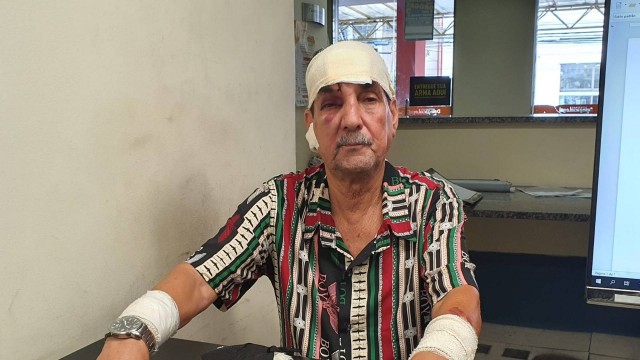 Luiz Carlos Ribeiro sofreu graves lesões após as agressões