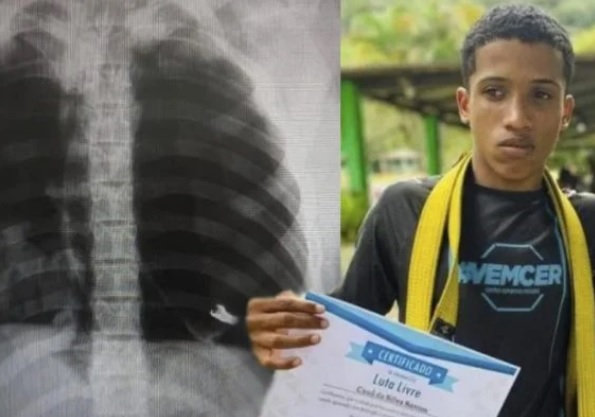 Laudo da morte de Cauã da Silva dos Santos mostra fragmento de fuzil no corpo de adolescente