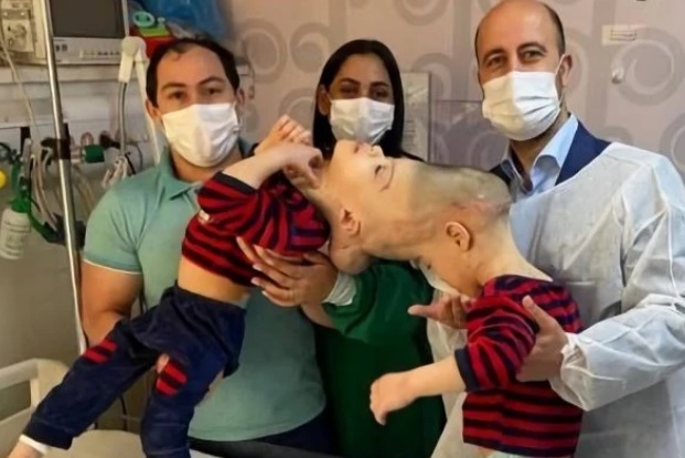 Arthur e Bernardo Lima, de 3 anos, ao lado dos pais e do cirurgião Noor Jeelani/Reprodução